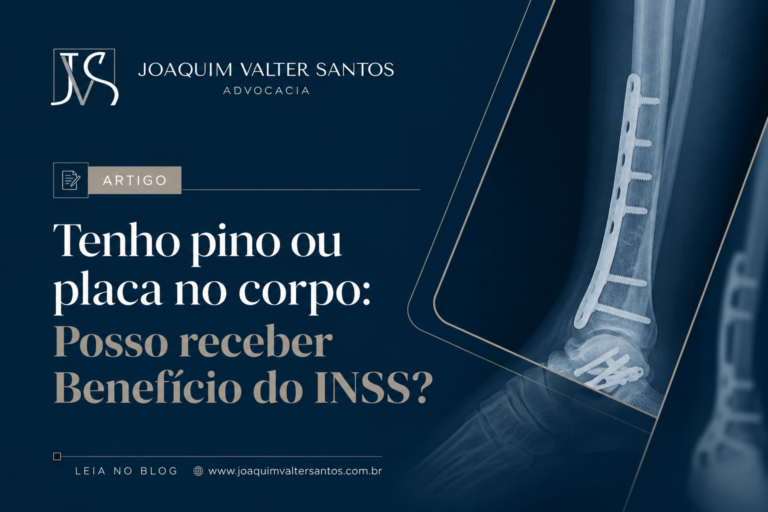 Tenho pino ou placa no corpo: Posso receber Benefício do INSS?