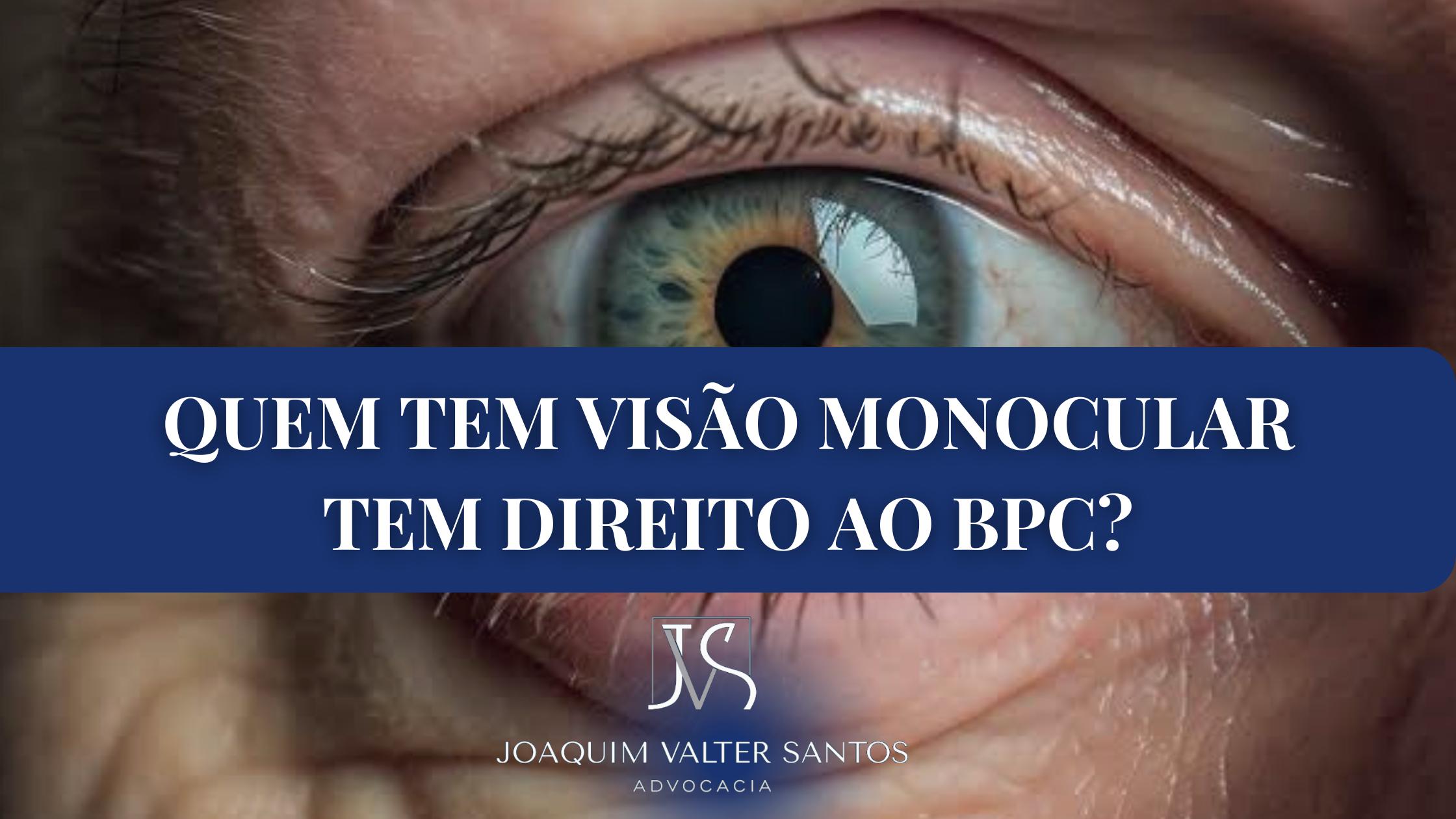 Quem tem Visão Monocular tem direito ao BPC LOAS?